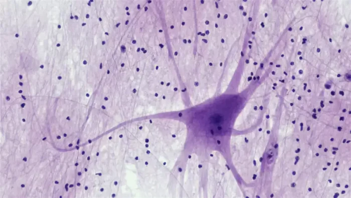 MND Nutrition Nerve cell